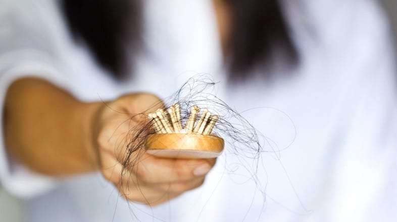 Alopecia femenina, tipos y causas