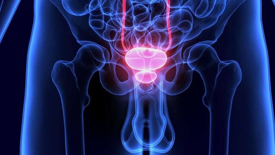 Cancer de próstata, rayos X análisis. La importancia de la detección